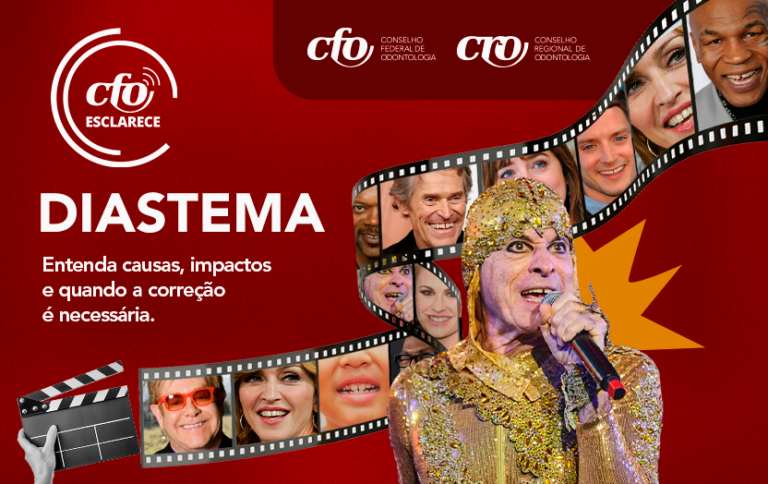 CFO Esclarece: Diastema - corrigir ou não corrigir? Eis a questão!