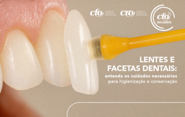 Lentes e facetas dentais: entenda os cuidados necessários para higienização e conservação