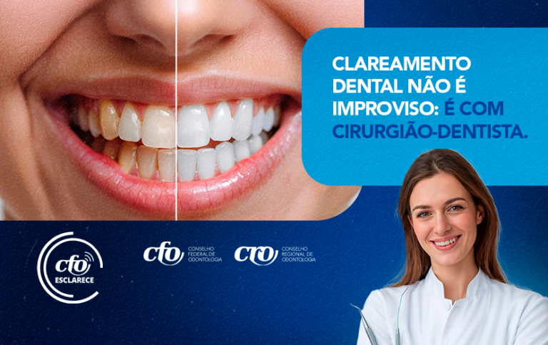 CFO Esclarece: antes do clareamento dental, saúde bucal deve estar em pleno equilíbrio